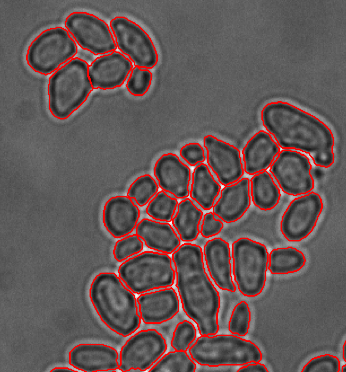 Enlarged view: Image segmentation for yeast cells.
